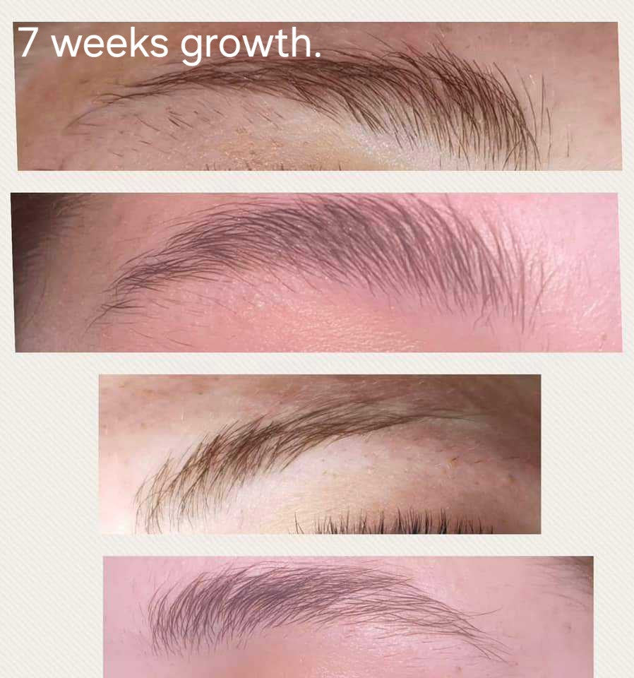 Retail Lash and Brow Serum – 10ml (Pack of 5 or 10)